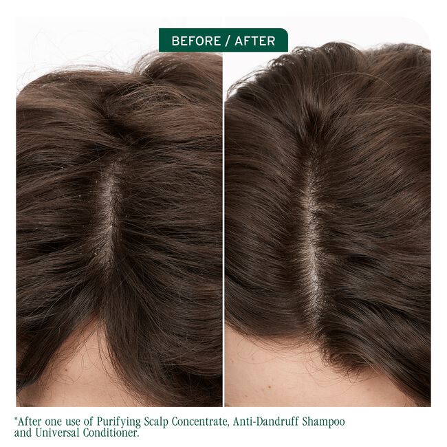 Biolage Scalp Sync Pyrithione Zinc Antidandruff Shampoo