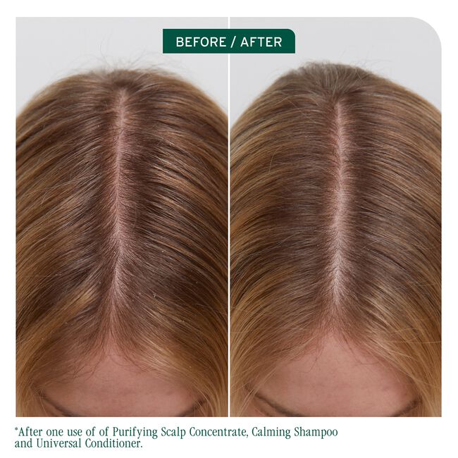 Biolage Scalp Sync Universal Conditioner